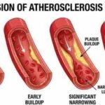Illustration showing how smoking, alcohol, and vaping affect erectile blood flow over time