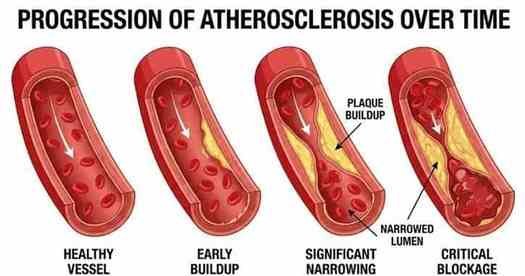 Illustration showing how smoking, alcohol, and vaping affect erectile blood flow over time